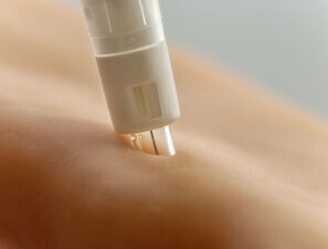 Bild zu Insulinapplikation - Smart-Pens: eine komplexe Story 
mit viel Zukunft!?