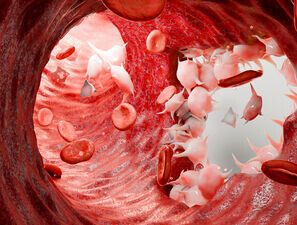 Bild zu Schwerpunkt Blutgerinnungssystem - Pathogenes und Ablauf der Blutgerinnung