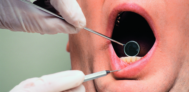 Bild zu  Parodontitis - Kranke Zähne erhöhen Blutdruck 