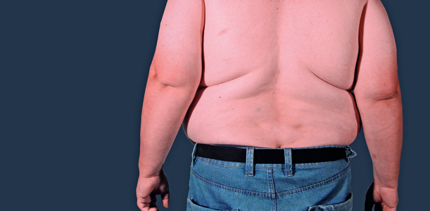 Bild zu Präventionserfolg - Zürich: Trend zu Übergewicht gestoppt