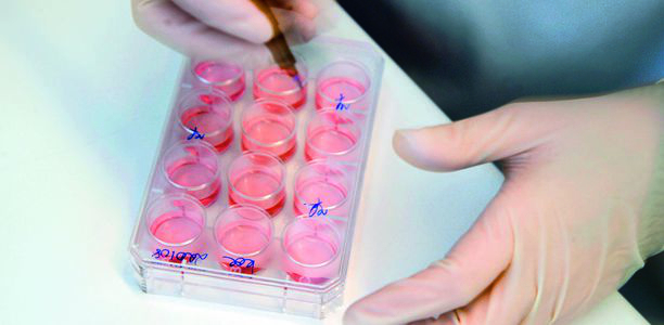 Bild zu Forschung - Stammzellen werden zu Betazellen: neue Chancen für die Zellersatztherapie