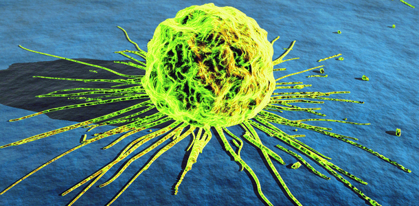 Bild zu Bauchspeicheldrüse - Pankreaskarzinom und Typ-2-Diabetes