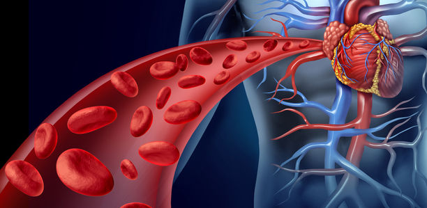 Bild zu Durchblutungsstörungen - Gefäße frühzeitig durchlässig machen