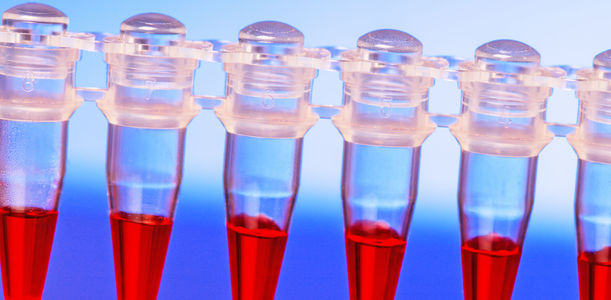 Bild zu Typ-1-Diabetes - Angeborene Immunantwort wichtiger als gedacht