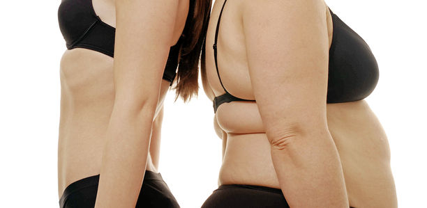 Bild zu Adipositas - Dickes Manko, schlanker Körper