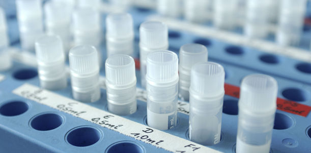 Bild zu DiMelli - Mehr Diabetesformen als vermutet  