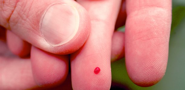 Bild zu Blutzuckerselbstkontrolle - VDBD-Leitfaden für Health Care Professionals