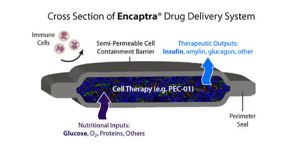 Bild zu Inselzelltransplantation - Verfahren erhält Genehmigung für Humanstudien