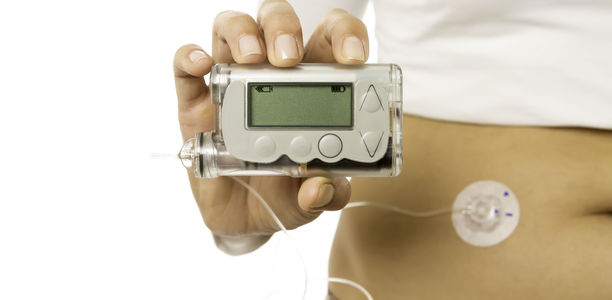 Bild zu SuP - Sensorunterstützte Pumpentherapie (SuP): Experten berichten über ihre Erfahrungen