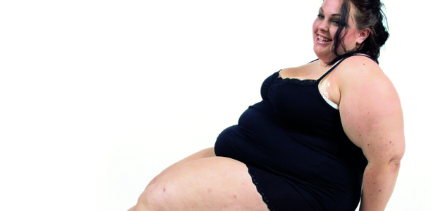 Bild zu Genetik - Übergewicht ist genetisch mitbestimmt