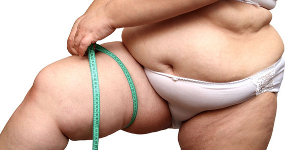 Bild zu Adipositas - Gefahr aus dem Fettgewebe für körperliche und psychische Gesundheit