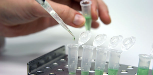 Bild zu Stammzellforschung - Nächster Schritt für Zellersatztherapie bei Typ-1-Diabetes