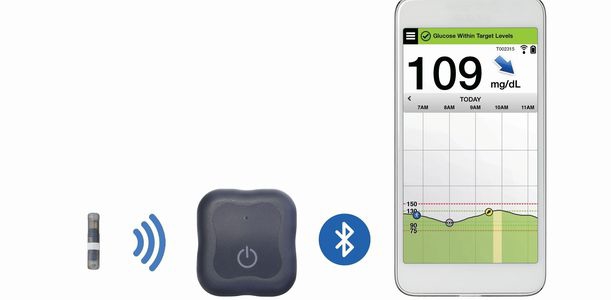 Bild zu CGM-Systeme - Eversense kommt nach Deutschland