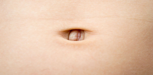 Bild zu Schwerpunkt: Insulinport - Fallbesispiel 3: mehrfachbehinderter Junge mit rezidivierenden Hautinfektionen