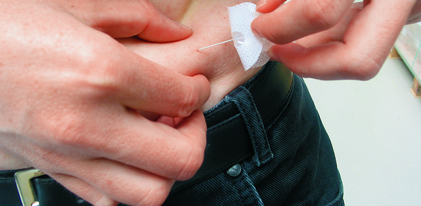 Bild zu Insulinpumpentherapie - Insulininfusionssets: eine kritische Neubewertung