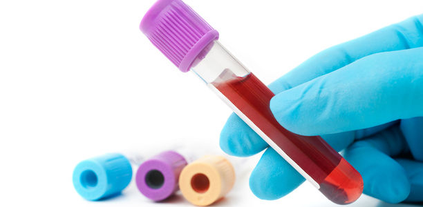 Bild zu Ernährung und Diabetes-Risiko - Fettsäuren im Blut geben Auskunft über Höhe des Ballaststoffverzehrs