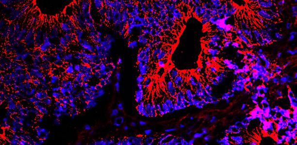 Bild zu Krebsvorsorge - Darmspiegelung schon ab 50 – vor allem für Männer