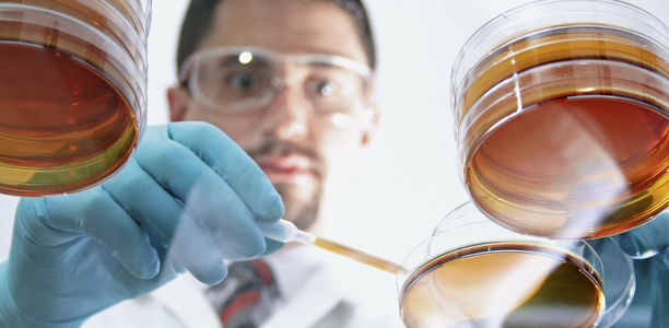 Bild zu Typ-2-Diabetes - Forscher entdecken neue Wirkstoffklasse