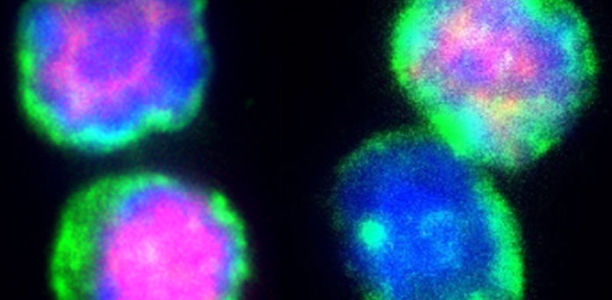 Bild zu Forschung - Regulatorische T-Zellen wichtig für Funktion des Fettgewebes