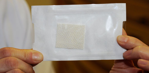 Bild zu Neues Verfahren - Fischhaut-Matrix lässt chronische Wunden heilen