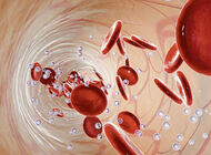 Bild zu Immunzellen - Die fatale Rolle der T-Zellen bei COVID-19