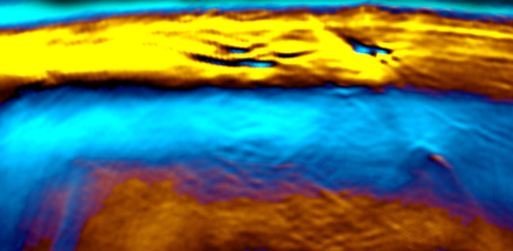 Bild zu Forschung - Braunes Fett wird durchschaubar