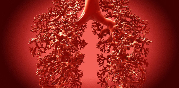 Bild zu Komorbidität - Menschen mit Typ-2-Diabetes leiden häufiger an restriktiven Lungenerkrankungen