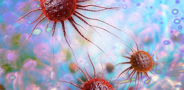 Bild zu BVKD – Die Diabetes-Kliniken - Diabetes mellitus und Krebserkrankungen