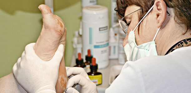 Bild zu Diabetischer Fuß - AOK Baden-Württemberg bietet neues Vertragsmodul an