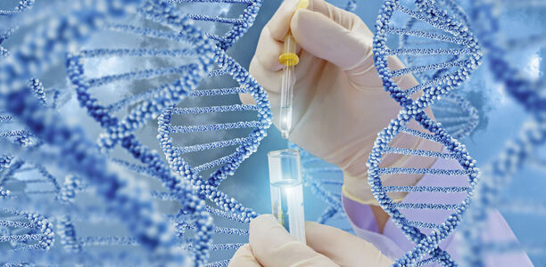 Bild zu Nicht-Alkoholische Fettleber - Weitere genetische Ursache entdeckt