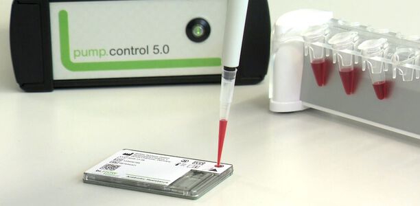 Bild zu Diabetisches Fußsyndrom - Neuer Schnelltest identifiziert Erreger binnen einer Stunde