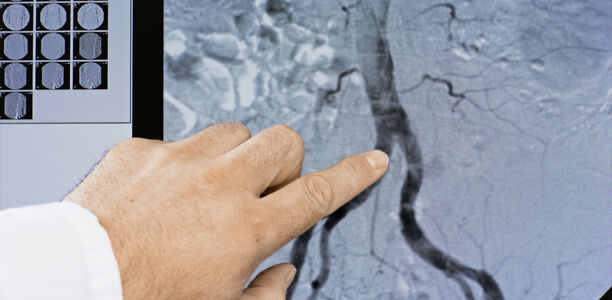 Bild zu Nutzen überwiegt Schaden - Angst vor Nierenschäden sollte Kontrastmittelgabe nicht ausschließen