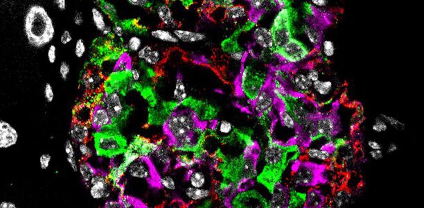 Bild zu Betazellfunktion wiederhergestellt - Neue Wirkstoffkombination könnte Diabetes-Remission ermöglichen