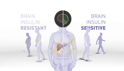 Bild zu DZD-Langzeitstudie - Insulinwirkung im Gehirn bestimmt das Körpergewicht und die Fettverteilung
