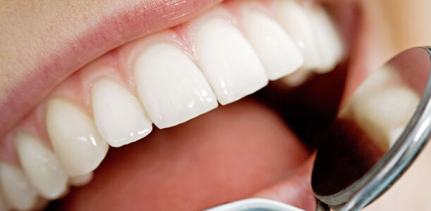 Bild zu Wechselwirkung - Diabetes und Parodontitis beeinflussen sich gegenseitig