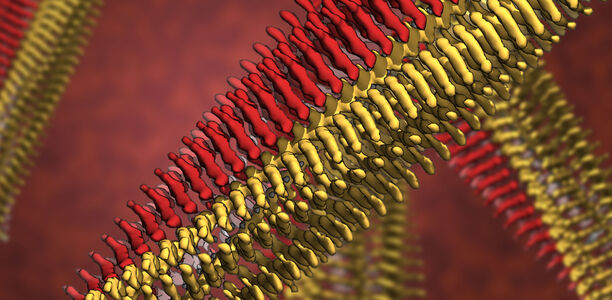 Bild zu Kryo-Elektronenmikroskopie - Neuer Hinweis auf Zusammenhang zwischen Alzheimer und Diabetes