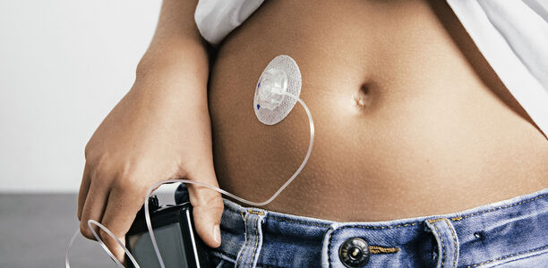 Bild zu Titelthema - Kontaktekzeme bei Kindern mit Typ-1-Diabetes
