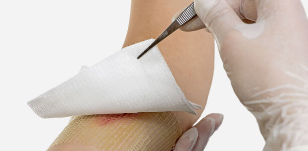 Bild zu Chronische Entzündungen - Chemokin-bindende Wundauflage ermöglicht Heilung der Haut