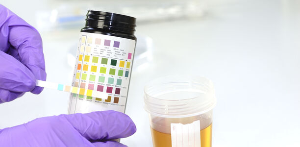 Bild zu Kinder und Jugendliche - Corona-Pandemie sorgt für verspätete Typ-1-Diabetes-Diagnosen