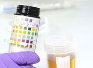 Bild zu Kinder und Jugendliche - Verspätete Diabetes-Diagnosen durch Corona-Pandemie