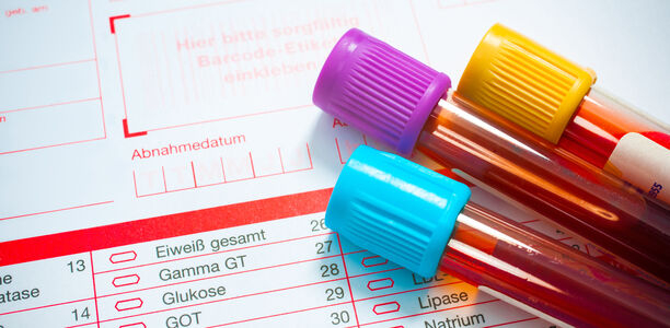 Bild zu Forschung - Neue Diabetes-Subgruppen zeigen unterschiedliche Entzündungsreaktionen