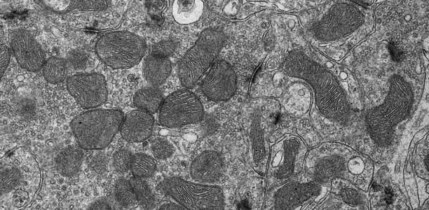 Bild zu Forschung - DNA-Bausteine regulieren Entzündung