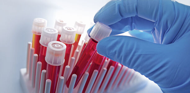 Bild zu Schwerpunkt „Kinder und Jugendliche“ - Projekte zur Früherkennung und Prävention