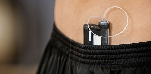 Bild zu Gesundheitspolitik - Bayern und Hessen: MDK häufig gegen CGM