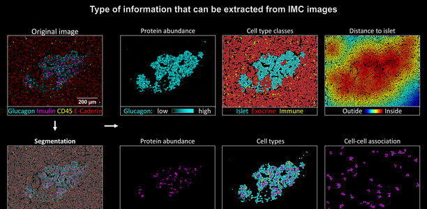 Bild zu Grundlagenforschung - Typ-1-Diabetes: Forscher stellen Beta-Zell-Zerstörung dar