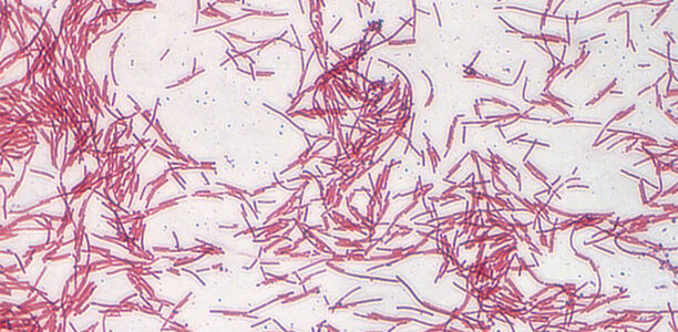 Bild zu Clostridium ramosum - Darmbakterium fördert Übergewicht