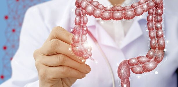 Bild zu Ernährung, Darmstammzellen & Krankheiten - Forschung deckt neuen Zusammenhang auf