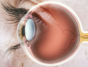 Bild zu Typ-1-Diabetes - Diabetesinduzierte Veränderungen des Auges