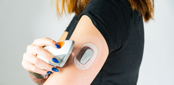 Bild zu Rückschritte in der Diabetesversorgung? - DDG und DGE warnen vor erschwertem Zugang zu CGM-Systeme