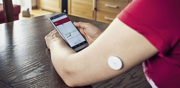 Bild zu Diabetes-Forum-Editorial - Selbstvermessung mit rtCGM
